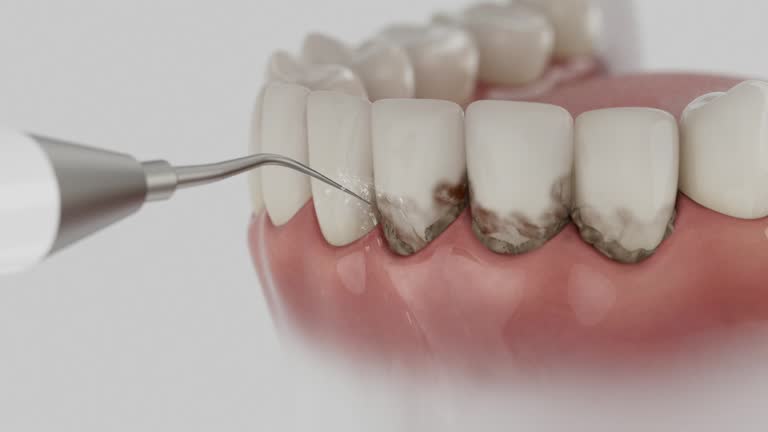 Trusted Teeth Cleaning And Checkup service in Ahoskie, NC - Dentist Open Now